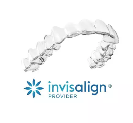 Apparecchio Invisalign invisibile